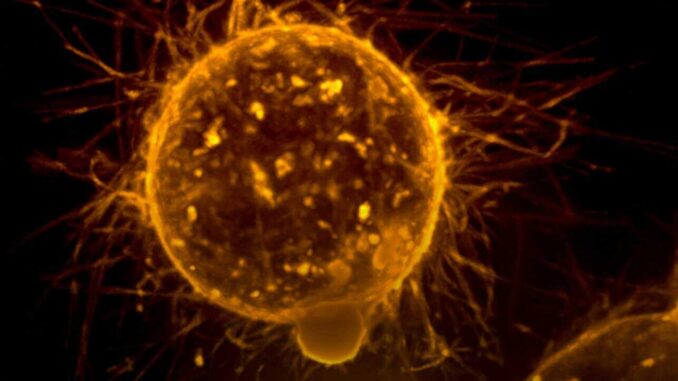 Un estudio en Hong Kong muestra resultados «prometedores» contra tres tipos de cáncer